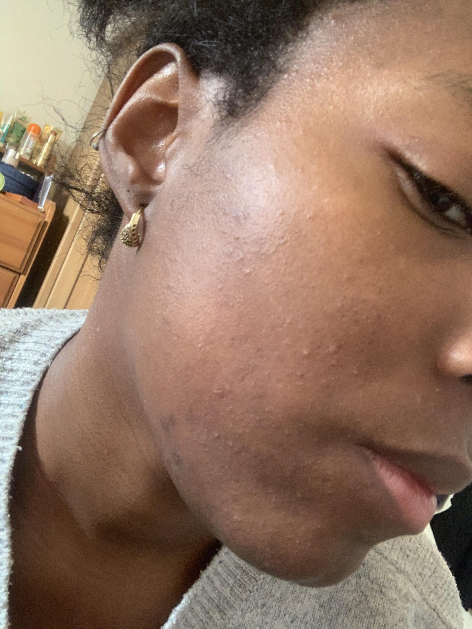 ⁠Dryness & Dehydration