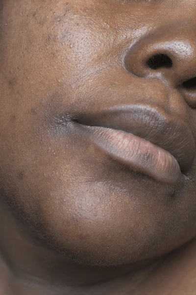 ⁠Oil Control & Pore Care